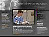 lithotripsy.anatomy.iupui.edu